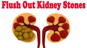 Why do you get kidney stones?