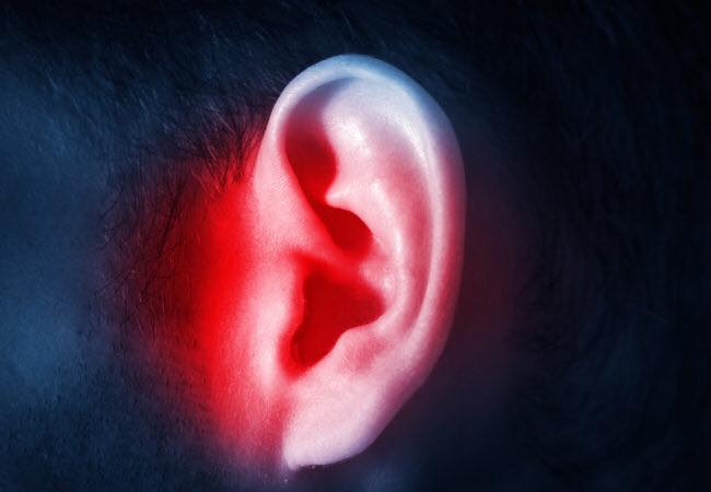 Tinnitus (ringing in the ears)