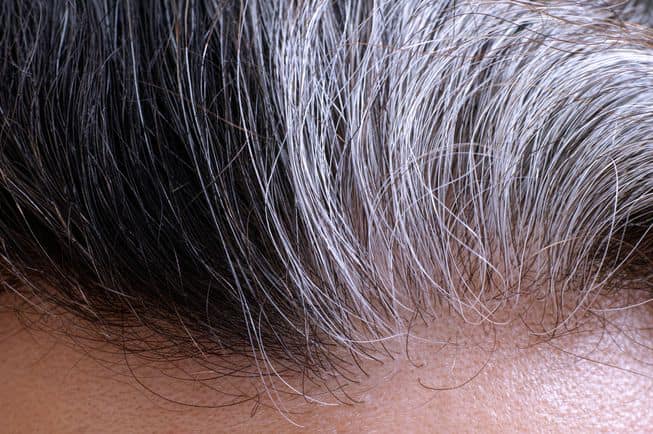 Why does hair turn grey?