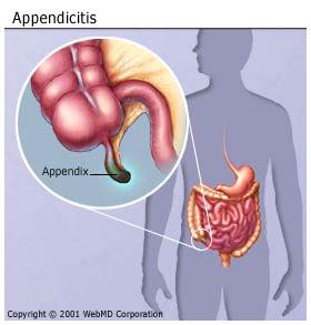 If your doctor tells you there is no purpose for your appendix he is a fool
