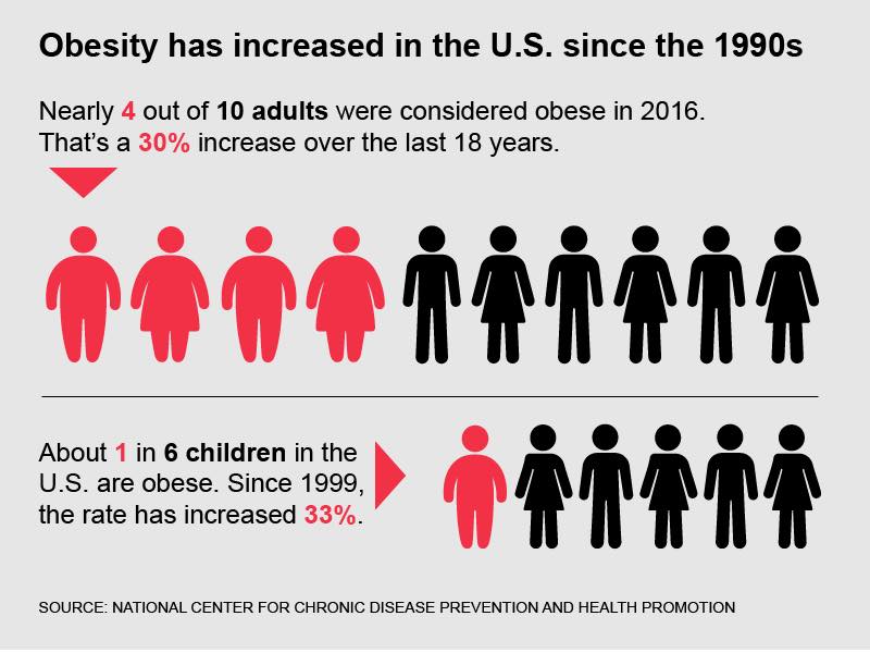 Obesity epidemic