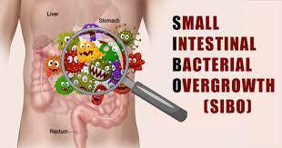 (SIBO) Small intestine bacteria overgrowth, and the carnivore keto diet fad