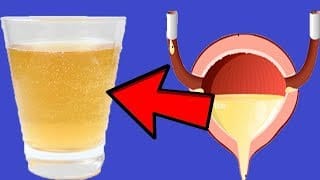 False kidney filtration