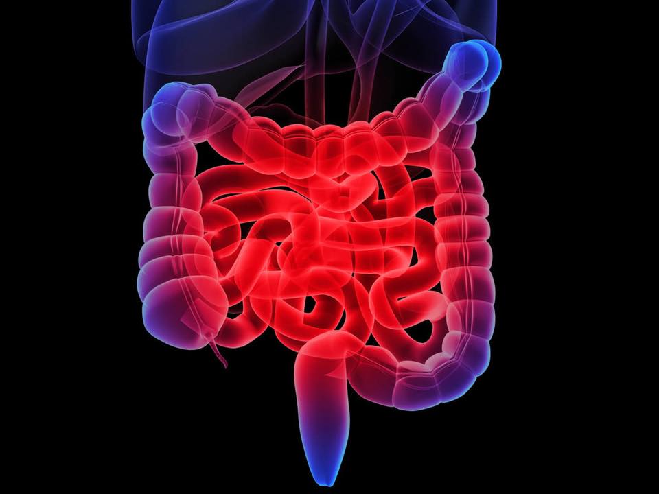 IBS is not a syndrome or a disease