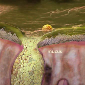 Mucus is not the cause of all “disease”
